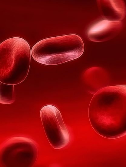 Anemia