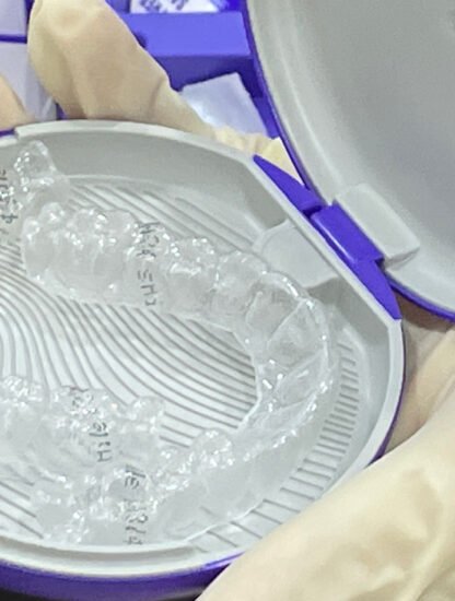 smiledirectclub-justsaying-asia-review-feature-2